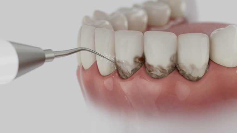 Trusted Emergency Dentist service in Livingston, TX - Dentist Open Now